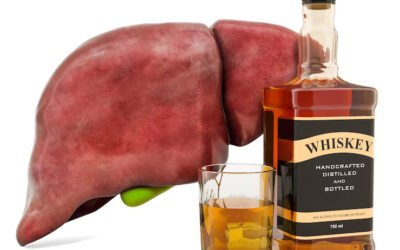 5 Alcoholic Liver Disease