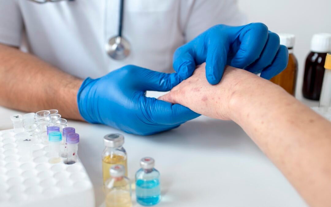 Fungal Infections Of The Skin And It’s Resistance – A Rising Menace