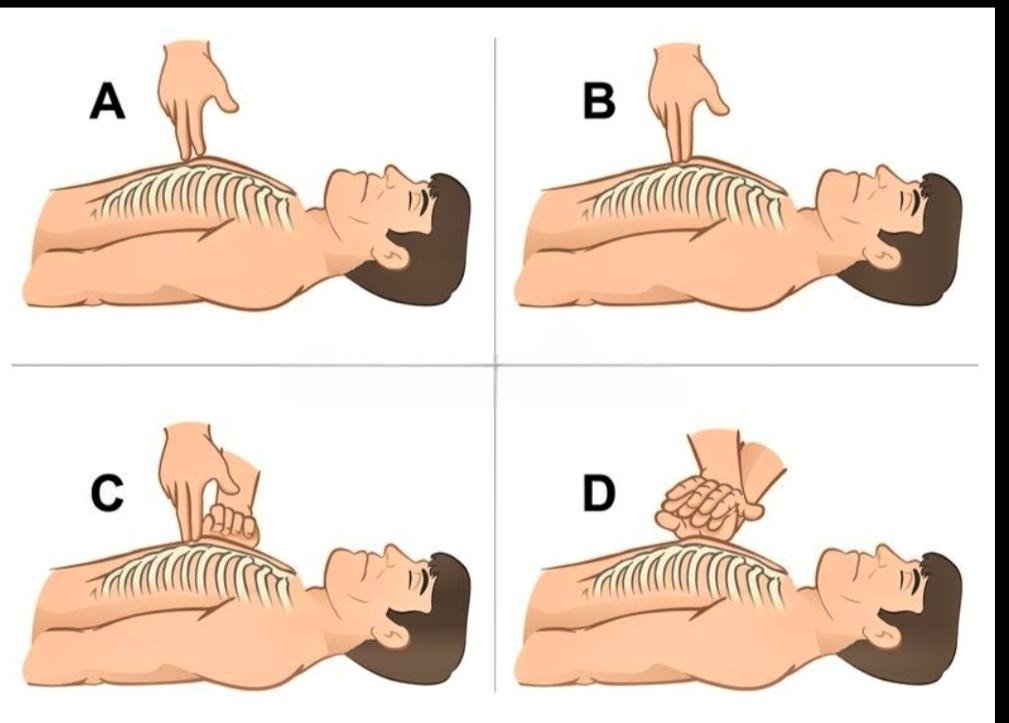 CPR Step 3